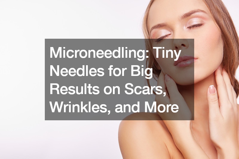 Microneedling Tiny Needles for Big Results on Scars, Wrinkles, and More